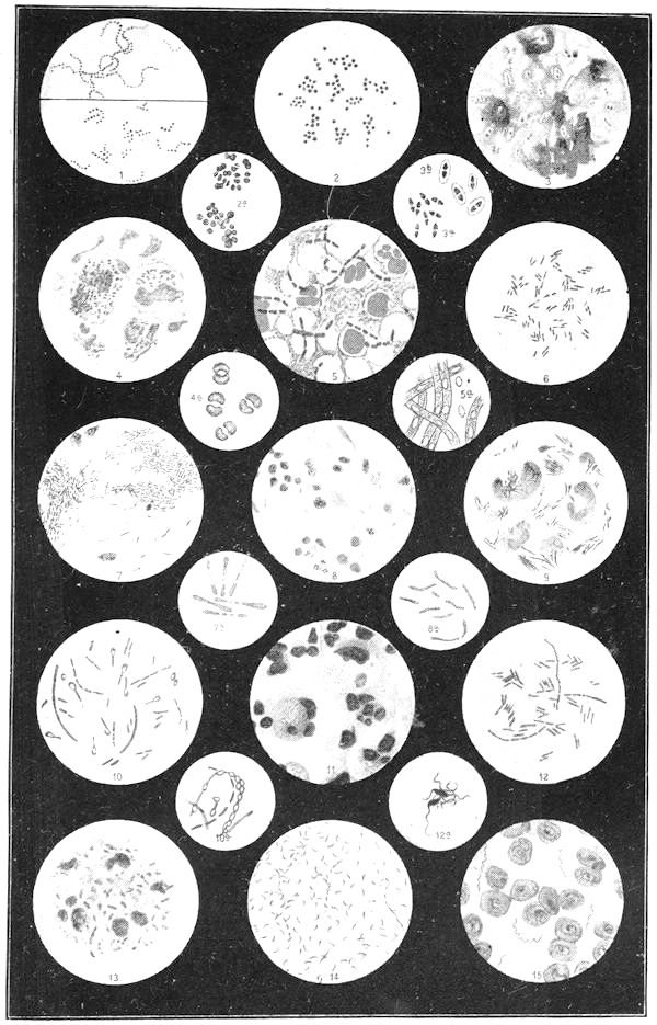 Various germs as seen under a microscope