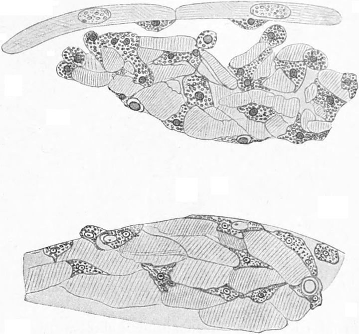 Muskelfasern während der   Metamorphose