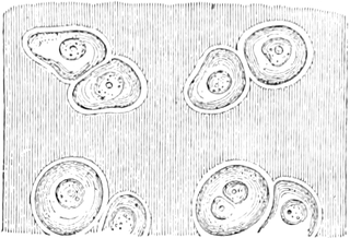 Knorpelzellen