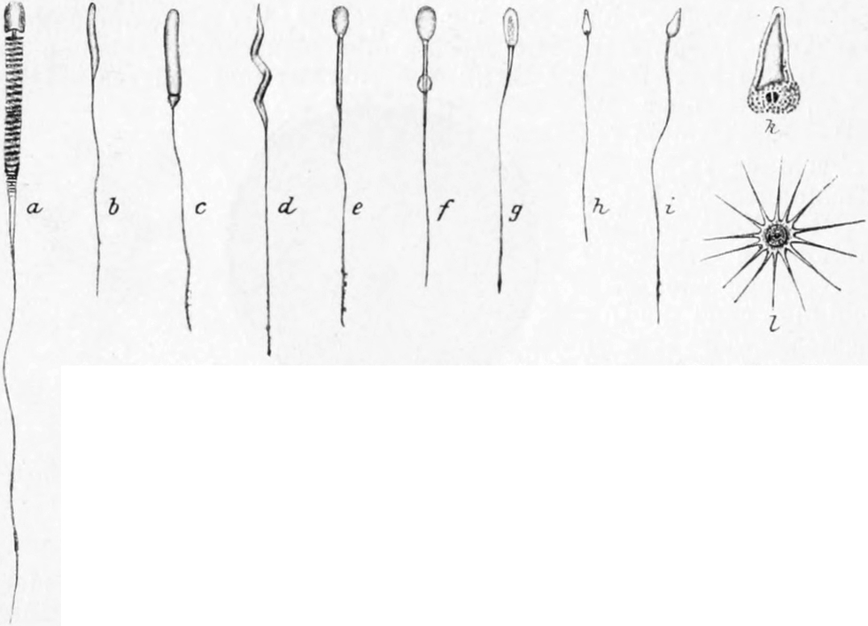 Unterschiedliche Spermatozoen