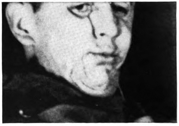 Pictures of a man's swollen and bloody face