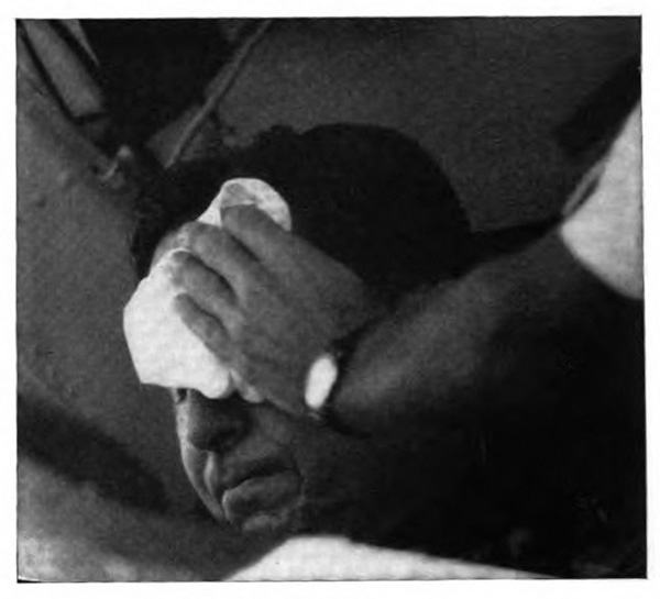 a man with a hand and towel at his eyes